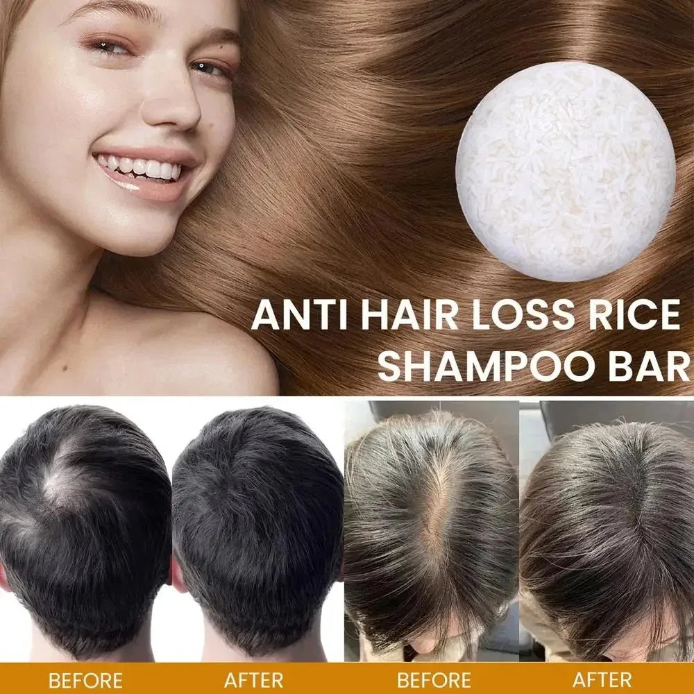 Organic Rice Shampoo Soap Bar Oil Free Conditioning Soap Rice Water Protein Nourishing Anti-Loss Hair Hair Growth Soap Bar